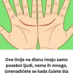 Ove linije na dlanu imaju samo posebni ljudi, nema ih mnogo, iznenadićete se kada čujete šta znače Ove linije na dlanu imaju samo posebni ljudi, nema ih mnogo, iznenadićete se kada čujete šta znače - featured image