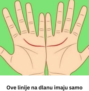 Ove linije na dlanu imaju samo posebni ljudi, nema ih mnogo, iznenadićete se kada čujete šta znače Ove linije na dlanu imaju samo posebni ljudi, nema ih mnogo, iznenadićete se kada čujete šta znače - featured image