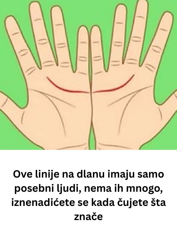 Ove linije na dlanu imaju samo posebni ljudi, nema ih mnogo, iznenadićete se kada čujete šta znače - featured image