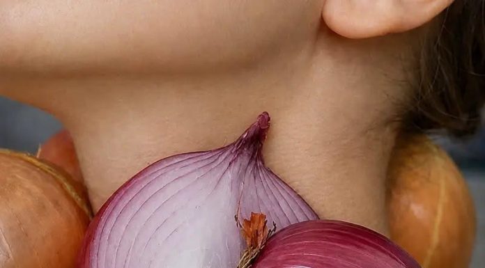 STAVILA JE CRVENI LUK NA VRAT I PRESPAVALA – Kad se probudila nije mogla da vjeruje! STAVILA JE CRVENI LUK NA VRAT I PRESPAVALA – Kad se probudila nije mogla da vjeruje! - featured image